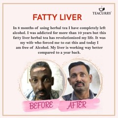 TEACURRY Fatty Liver Tea (1 Month Pack, 30 Tea Bags) – Helps With Fatty Liver